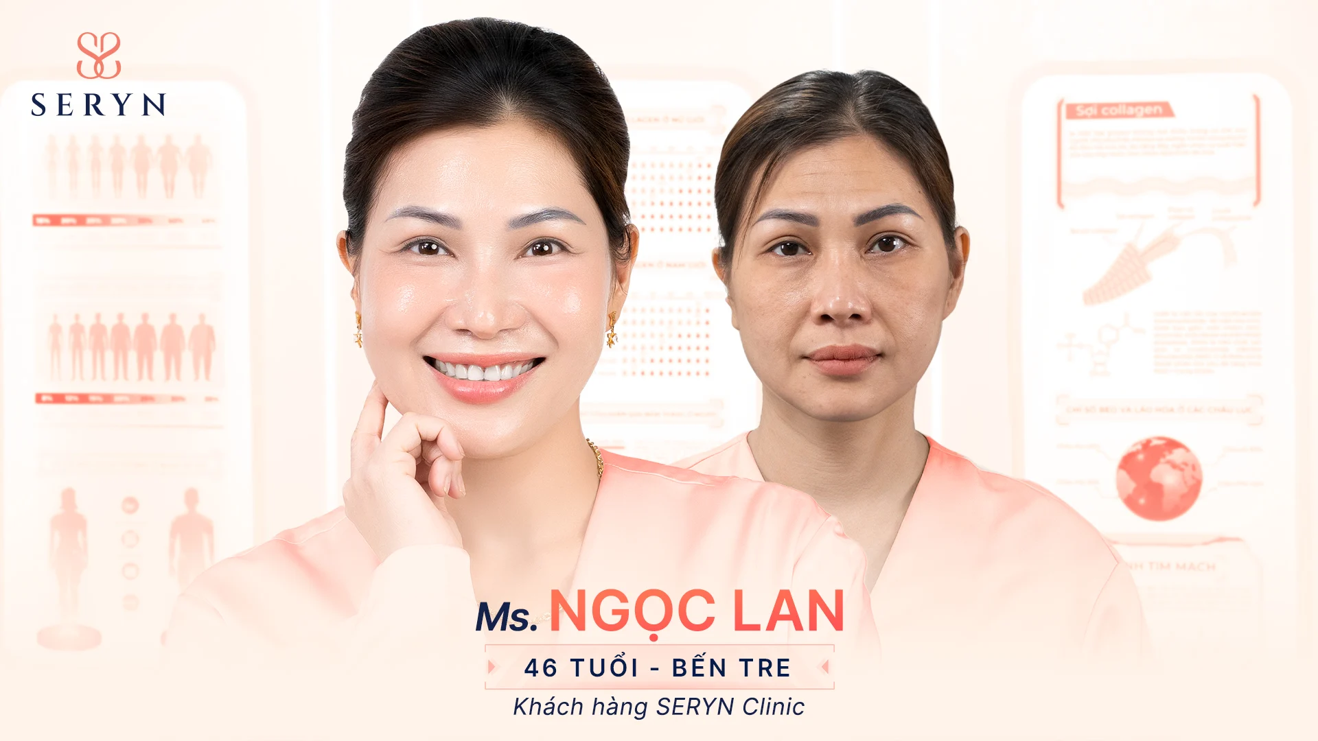 HỤ NỮ THÔNG MINH ƯU TIÊN TRẺ HÓA TỰ NHIÊN TẠI SERYN CLINIC 2