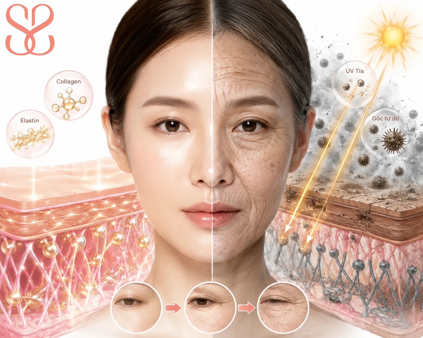 Vì sao da mặt lão hóa sớm và hình thành nếp nhăn?