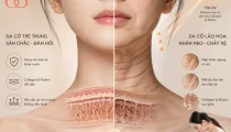 Vì sao vùng cổ lão hóa nhanh hơn da mặt?