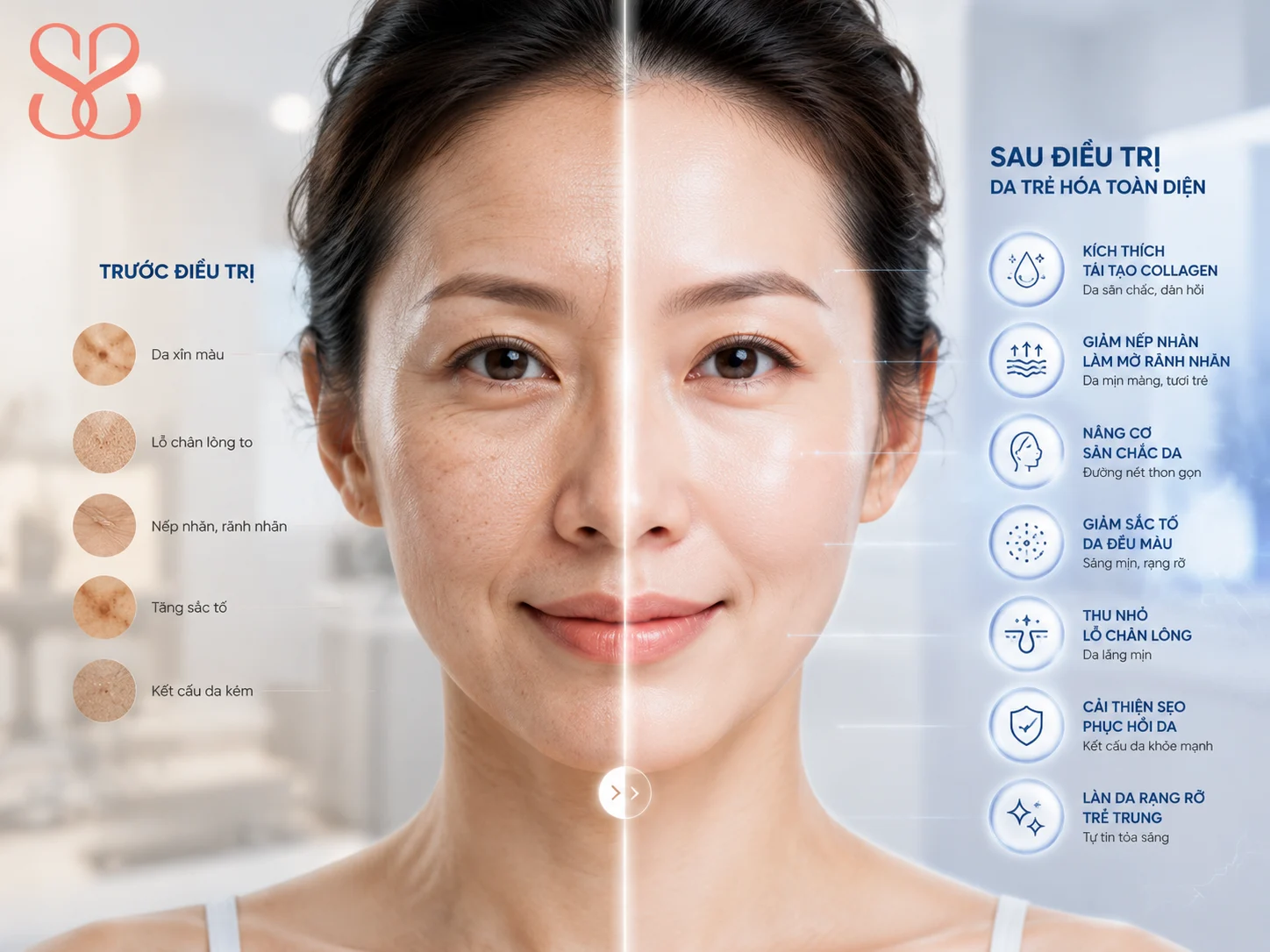 7 lợi ích nổi bật của trẻ hoá da bằng công nghệ laser