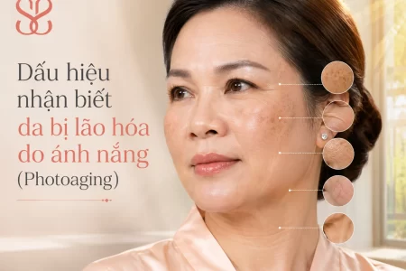 Dấu hiệu nhận biết da bị lão hóa do ánh nắng (Photoaging)