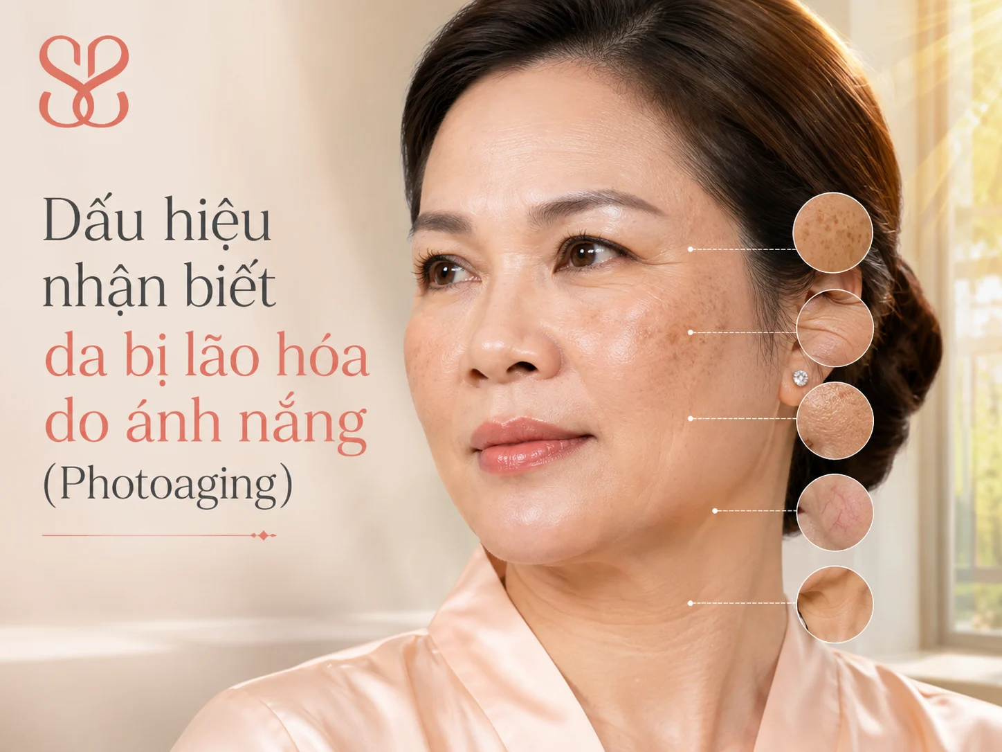 Dấu hiệu nhận biết da bị lão hóa do ánh nắng (Photoaging)