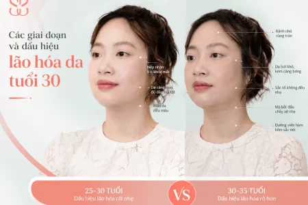 Các giai đoạn và dấu hiệu lão hóa da tuổi 30