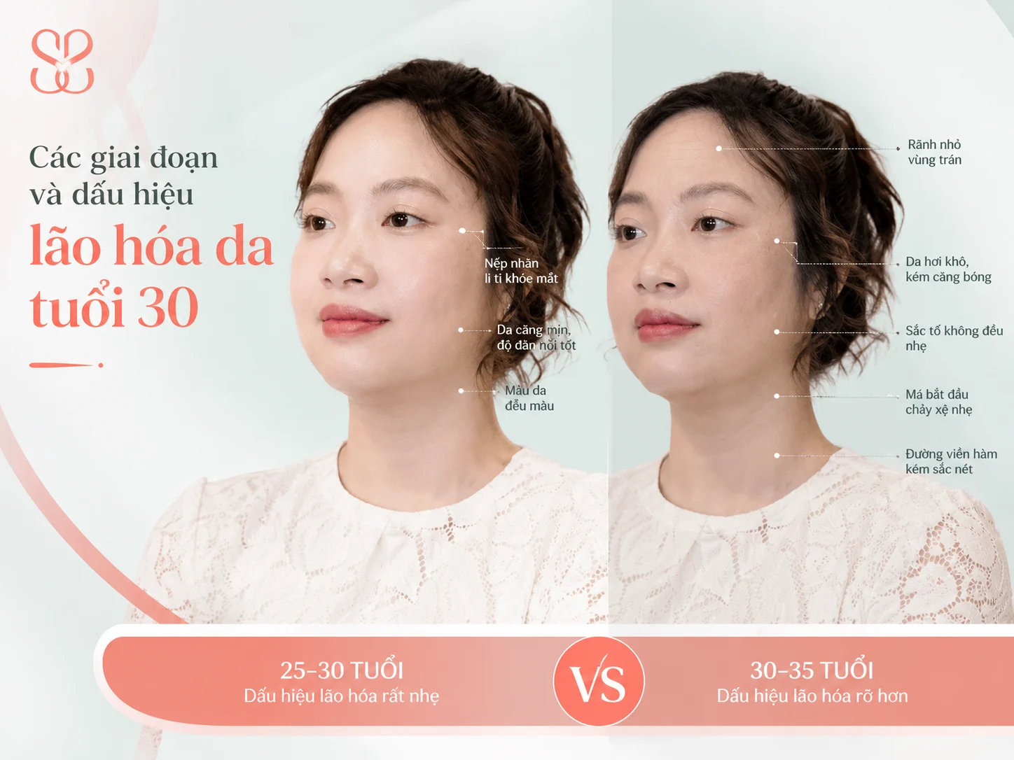 Các giai đoạn và dấu hiệu lão hóa da ở tuổi 30 cần chú ý Các giai đoạn và dấu hiệu lão hóa da ở tuổi 30 cần chú ý