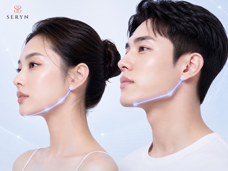 Sợi chỉ được đặt theo hướng định sẵn để hỗ trợ nâng đỡ và định hình đường viền hàm Sợi chỉ được đặt theo hướng định sẵn để hỗ trợ nâng đỡ và định hình đường viền hàm