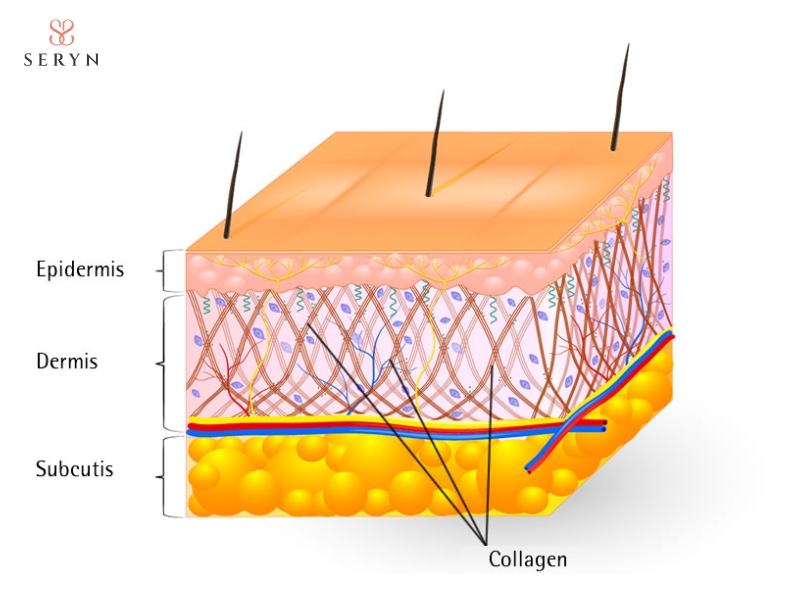 Collagen mới tiếp tục hỗ trợ cấu trúc da sau khi sợi chỉ tiêu hoàn toàn. Collagen mới tiếp tục hỗ trợ cấu trúc da sau khi sợi chỉ tiêu hoàn toàn.