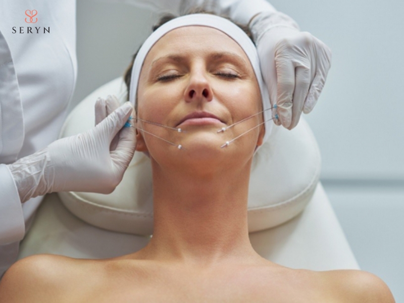 Căng da mặt bằng chỉ sử dụng chỉ sinh học để nâng đỡ mô và kích thích tái tạo collagen Căng da mặt bằng chỉ sử dụng chỉ sinh học để nâng đỡ mô và kích thích tái tạo collagen