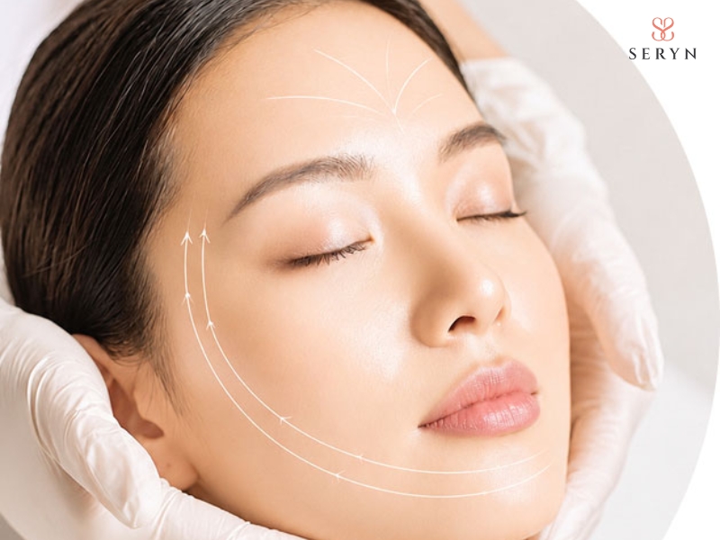 Chỉ sinh học tạo lực nâng mô chùng và kích thích collagen quanh vùng điều trị Chỉ sinh học tạo lực nâng mô chùng và kích thích collagen quanh vùng điều trị