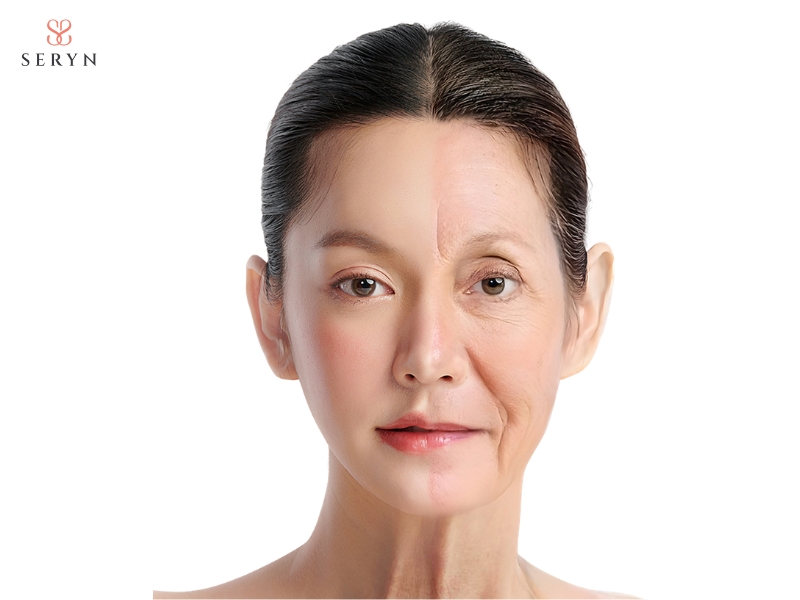 Facelift tác động trực tiếp vào da thừa và mô nâng đỡ để cải thiện tình trạng chảy xệ rõ rệt Facelift tác động trực tiếp vào da thừa và mô nâng đỡ để cải thiện tình trạng chảy xệ rõ rệt