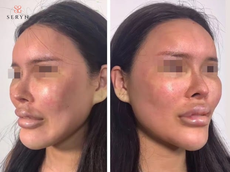 Cơ sở có mức giá quá thấp có thể tiềm ẩn rủi ro về thiết bị và quy trình điều trị Cơ sở có mức giá quá thấp có thể tiềm ẩn rủi ro về thiết bị và quy trình điều trị