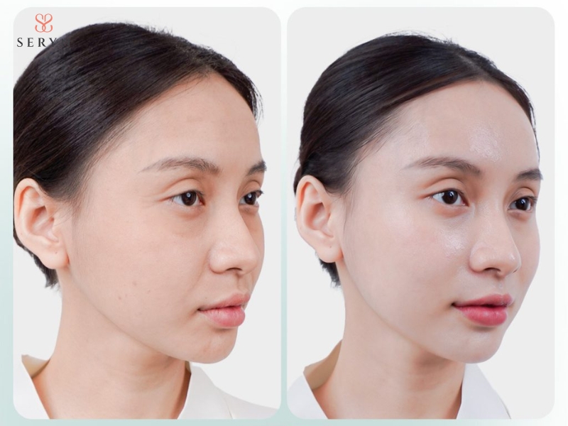 Hiệu quả và mức độ phù hợp là những yếu tố cần cân nhắc khi đầu tư trẻ hóa da Hiệu quả và mức độ phù hợp là những yếu tố cần cân nhắc khi đầu tư trẻ hóa da