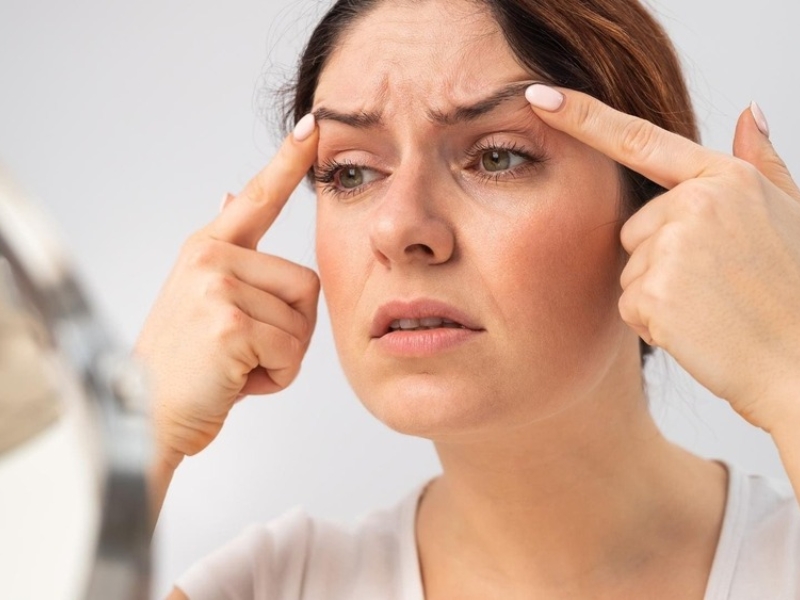 Sau tuổi 45, da dễ xuất hiện nếp nhăn sâu, chảy xệ và mất thể tích rõ hơn Sau tuổi 45, da dễ xuất hiện nếp nhăn sâu, chảy xệ và mất thể tích rõ hơn