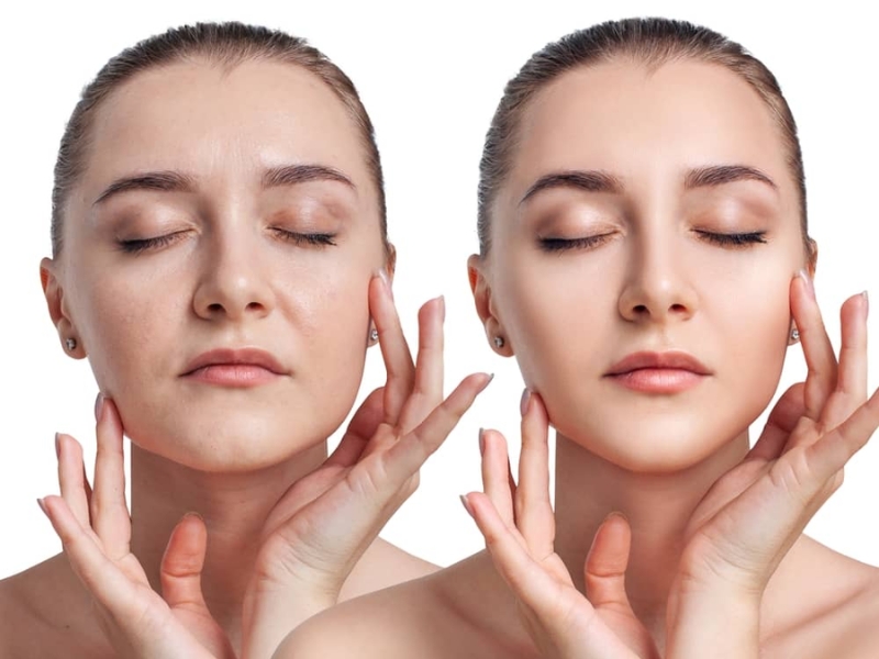 Chống lão hóa da giúp làm chậm quá trình suy giảm collagen, elastin và khả năng tái tạo tự nhiên của da Chống lão hóa da giúp làm chậm quá trình suy giảm collagen, elastin và khả năng tái tạo tự nhiên của da