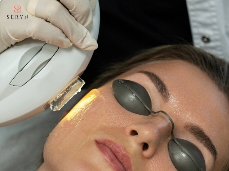 IPL sử dụng ánh sáng đa bước sóng để cải thiện sắc tố và các vấn đề da bề mặt IPL sử dụng ánh sáng đa bước sóng để cải thiện sắc tố và các vấn đề da bề mặt