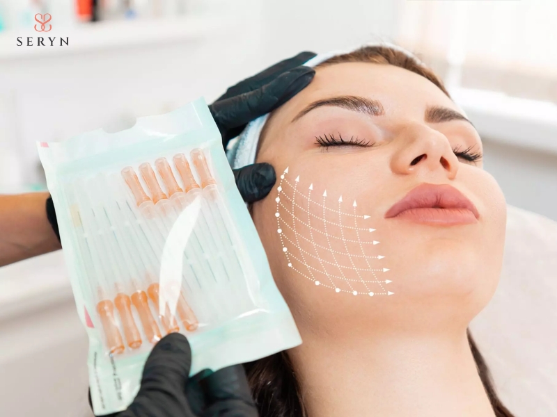 Nâng cơ mặt bằng chỉ sử dụng chỉ sinh học để nâng đỡ mô chùng và kích thích sản sinh collagen Nâng cơ mặt bằng chỉ sử dụng chỉ sinh học để nâng đỡ mô chùng và kích thích sản sinh collagen