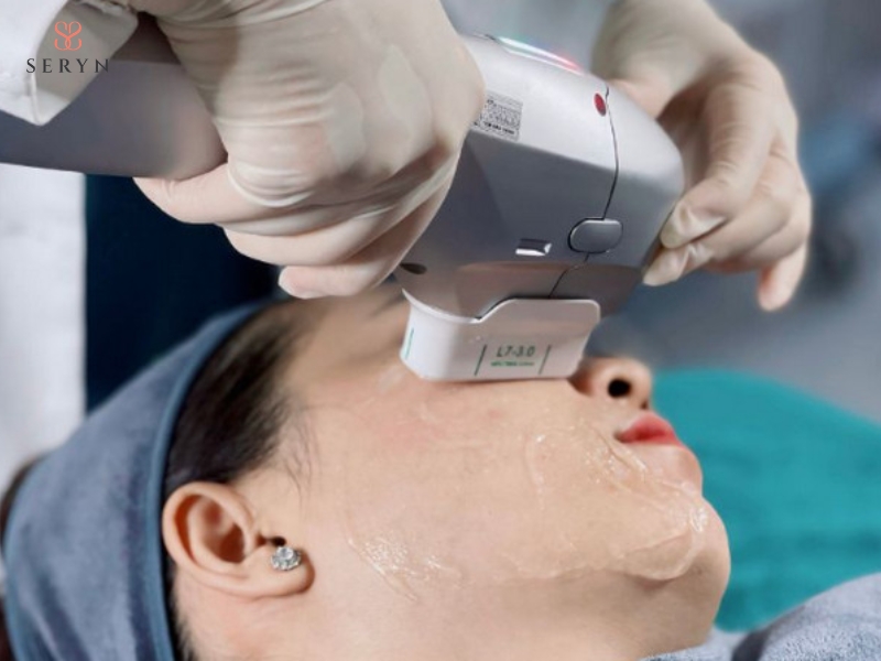 HIFU không phẫu thuật, có cơ chế tác động sâu hơn RF và ít can thiệp hơn HIFU không phẫu thuật, có cơ chế tác động sâu hơn RF và ít can thiệp hơn