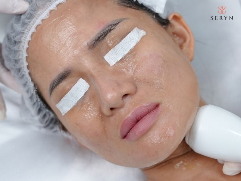 Nâng cơ mặt bằng công nghệ phù hợp với tình trạng da chùng nhẹ ở giai đoạn lão hóa sớm, 28-38 tuổi Nâng cơ mặt bằng công nghệ phù hợp với tình trạng da chùng nhẹ ở giai đoạn lão hóa sớm, 28-38 tuổi