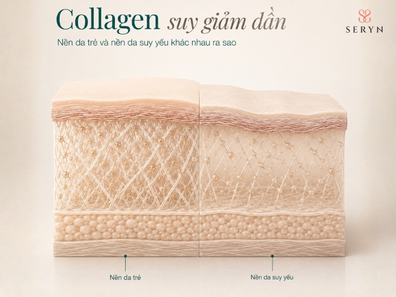 Collagen suy giảm và mất mỡ dưới da góp phần làm thay đổi cấu trúc khuôn mặt theo tuổi Collagen suy giảm và mất mỡ dưới da góp phần làm thay đổi cấu trúc khuôn mặt theo tuổi