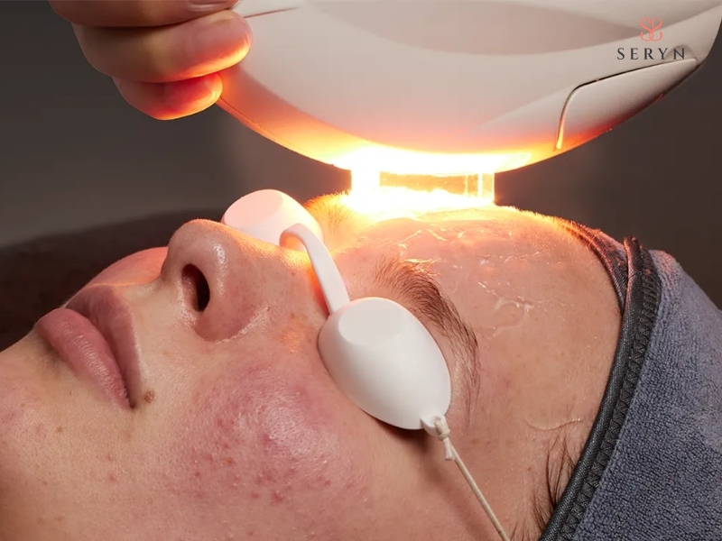Quy trình thực hiện trẻ hóa da bằng IPL chuẩn y khoa Quy trình thực hiện trẻ hóa da bằng IPL chuẩn y khoa