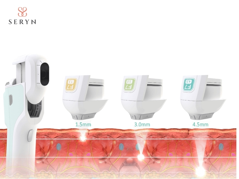 Nhiệt từ HIFU kích thích nguyên bào sợi hoạt động và thúc đẩy quá trình hình thành collagen mới Nhiệt từ HIFU kích thích nguyên bào sợi hoạt động và thúc đẩy quá trình hình thành collagen mới