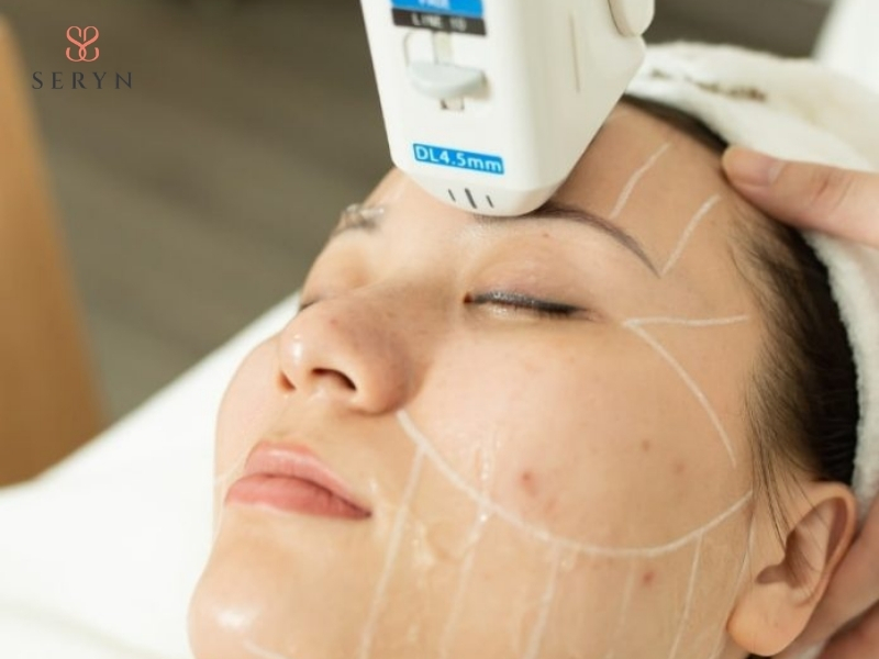 HIFU tác động qua da đến các lớp mô sâu mà không cần rạch mổ hoặc phẫu thuật HIFU tác động qua da đến các lớp mô sâu mà không cần rạch mổ hoặc phẫu thuật