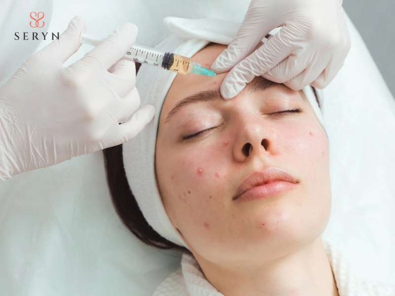 PRP phù hợp với da lão hóa mức độ nhẹ đến trung bình PRP phù hợp với da lão hóa mức độ nhẹ đến trung bình