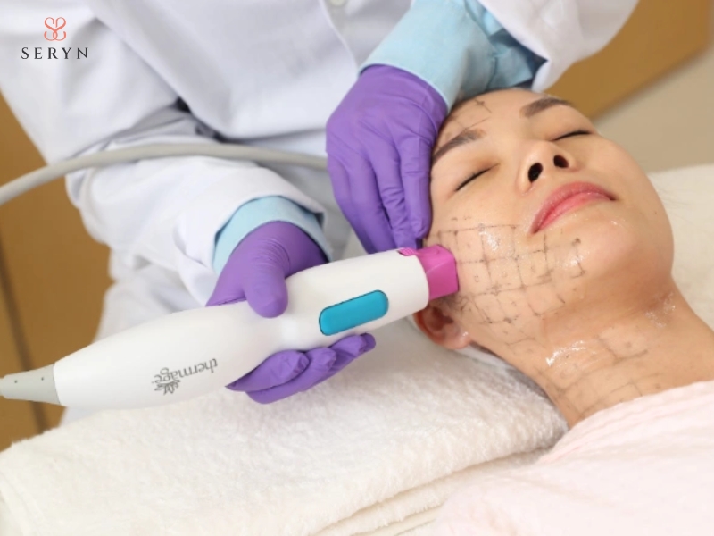Thermage tác động trên vùng da rộng, hỗ trợ cải thiện độ săn chắc và kết cấu da đồng đều Thermage tác động trên vùng da rộng, hỗ trợ cải thiện độ săn chắc và kết cấu da đồng đều