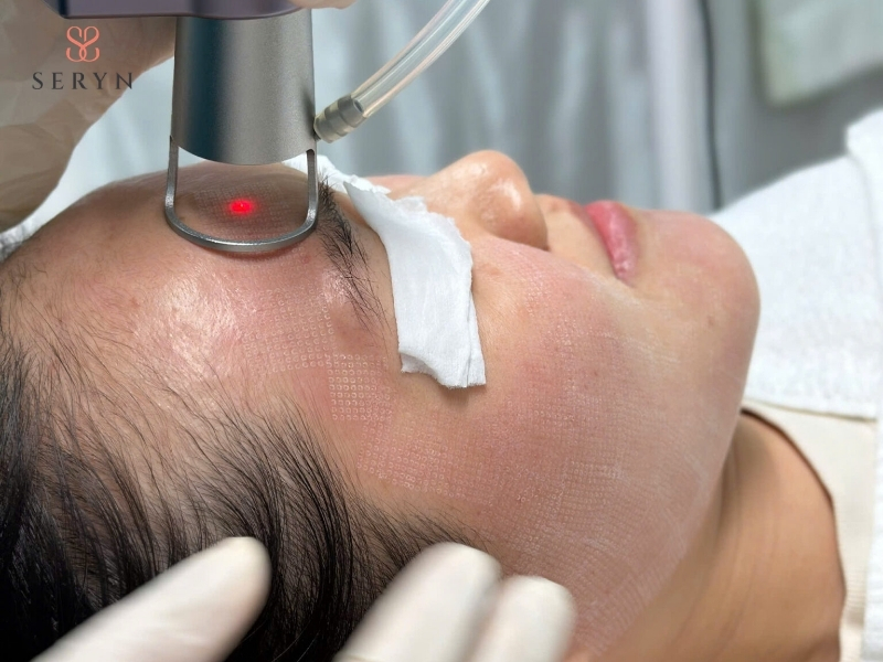 Các phương pháp xâm lấn tối thiểu đưa hoạt chất hoặc vật liệu vào dưới da để tạo tác động trực tiếp hơn Các phương pháp xâm lấn tối thiểu đưa hoạt chất hoặc vật liệu vào dưới da để tạo tác động trực tiếp hơn