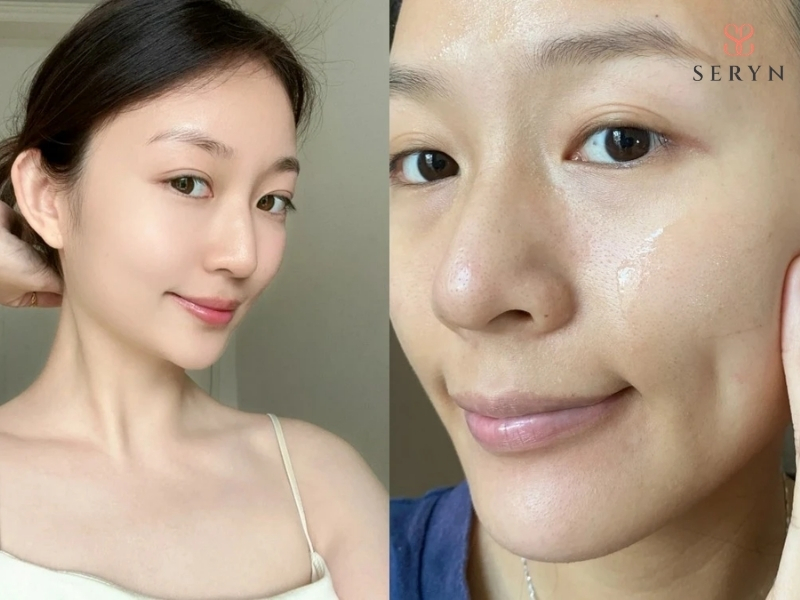 Giai đoạn tiền lão hóa 25–35 tuổi nên chăm sóc da và các phương pháp tác động nhẹ Giai đoạn tiền lão hóa 25–35 tuổi nên chăm sóc da và các phương pháp tác động nhẹ