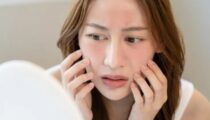 Biến chứng khi làm đầy má hóp là những phản ứng bất thường sau thủ thuật