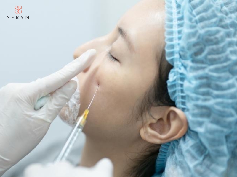 Filler bổ sung thể tích cho vùng mô lõm, phù hợp với nếp nhăn tĩnh và rãnh sâu Filler bổ sung thể tích cho vùng mô lõm, phù hợp với nếp nhăn tĩnh và rãnh sâu