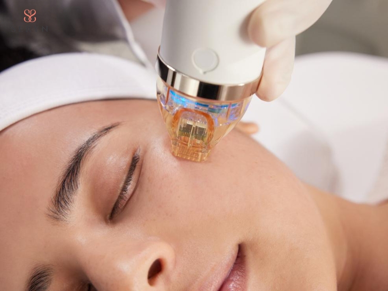 Công nghệ không xâm lấn sử dụng năng lượng có kiểm soát để kích thích collagen và cải thiện độ săn chắc da Công nghệ không xâm lấn sử dụng năng lượng có kiểm soát để kích thích collagen và cải thiện độ săn chắc da