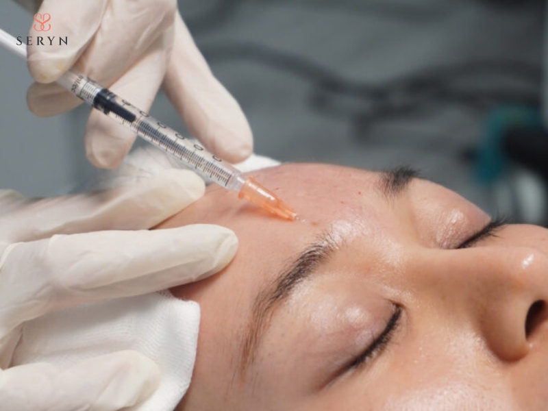 Botox làm giảm hoạt động của cơ, phù hợp với các nếp nhăn hình thành khi biểu cảm Botox làm giảm hoạt động của cơ, phù hợp với các nếp nhăn hình thành khi biểu cảm