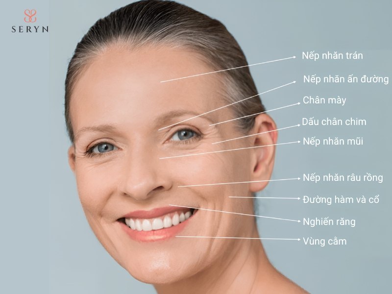 Lựa chọn phương pháp xóa nhăn dựa trên vị trí và mức độ nếp nhăn Lựa chọn phương pháp xóa nhăn dựa trên vị trí và mức độ nếp nhăn