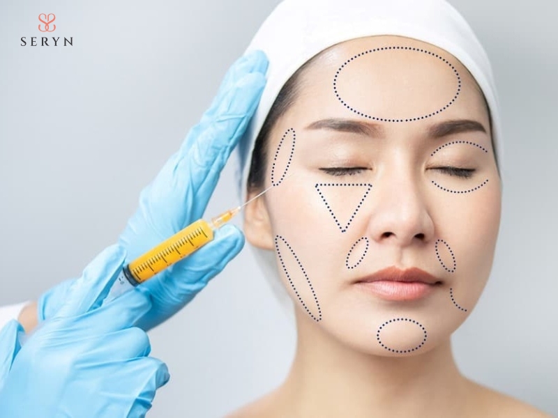 Cấy mỡ tự thân sử dụng mô mỡ từ chính cơ thể để bổ sung thể tích cho vùng má hóp Cấy mỡ tự thân sử dụng mô mỡ từ chính cơ thể để bổ sung thể tích cho vùng má hóp