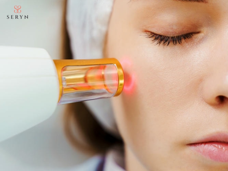 Laser tác động có kiểm soát lên da quanh mắt để kích thích quá trình tái tạo collagen Laser tác động có kiểm soát lên da quanh mắt để kích thích quá trình tái tạo collagen