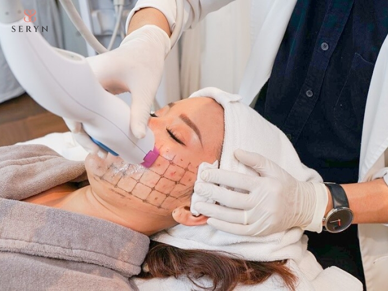 Thermage sử dụng năng lượng radiofrequency để kích thích tái tạo collagen Thermage sử dụng năng lượng radiofrequency để kích thích tái tạo collagen