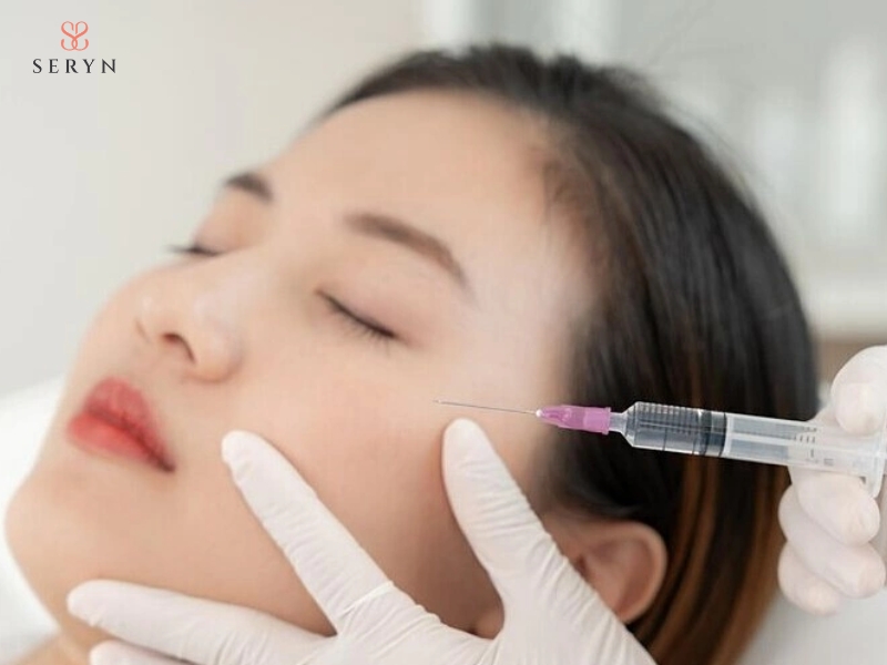 Filler HA được tiêm vào mô dưới da để bổ sung thể tích cho vùng má bị lõm Filler HA được tiêm vào mô dưới da để bổ sung thể tích cho vùng má bị lõm