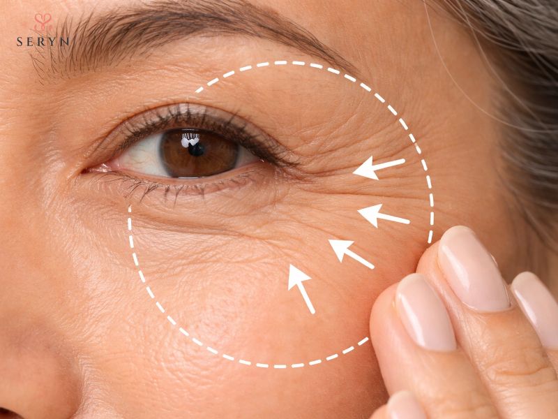Tia UV thúc đẩy quá trình phân hủy collagen và làm da quanh mắt lão hóa nhanh hơn Tia UV thúc đẩy quá trình phân hủy collagen và làm da quanh mắt lão hóa nhanh hơn