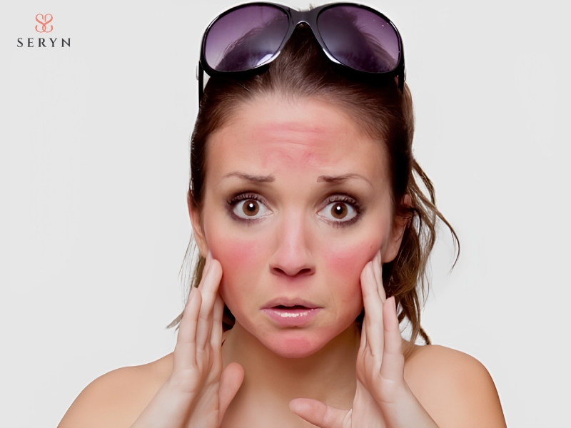 Tia UV có thể khiến rãnh cười xuất hiện sớm Tia UV có thể khiến rãnh cười xuất hiện sớm