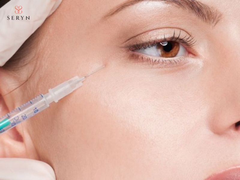 Filler HA bổ sung thể tích cho vùng lõm, giúp làm đầy và làm mờ nếp nhăn tĩnh Filler HA bổ sung thể tích cho vùng lõm, giúp làm đầy và làm mờ nếp nhăn tĩnh
